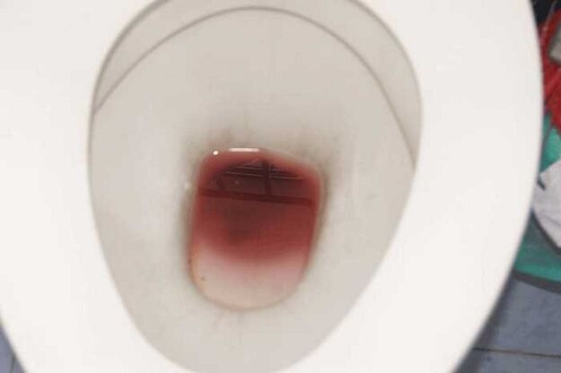 уочавање код мушкараца када су узбуђени